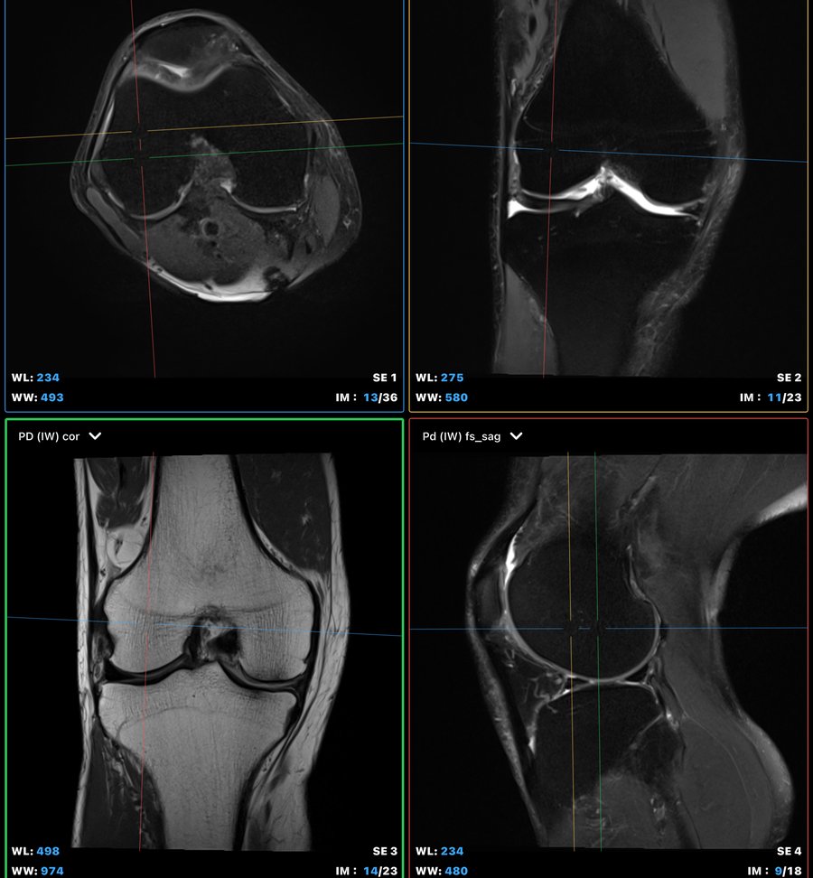 MRI findings and treatment planning
