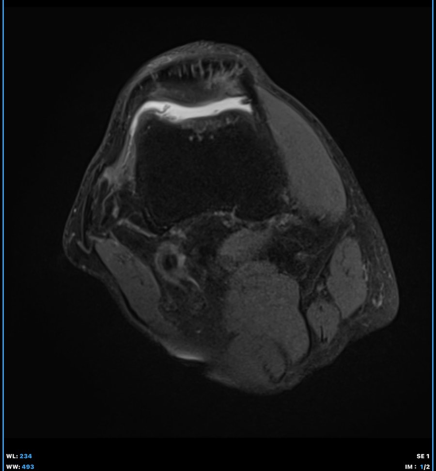 3T Knee MRI Evaluation — Cellforce One Clinic Tokyo